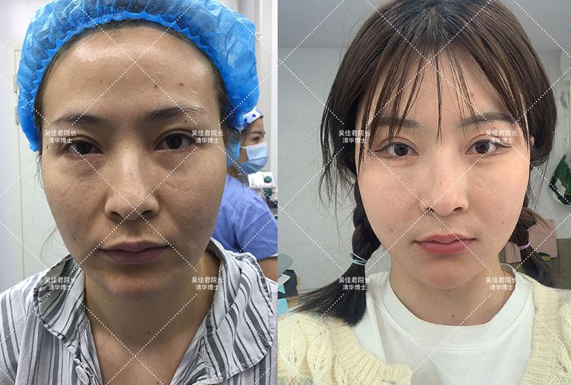 新澳门三期内必开一肖的警惕虚假宣传-全面释义、实证解答解释落实